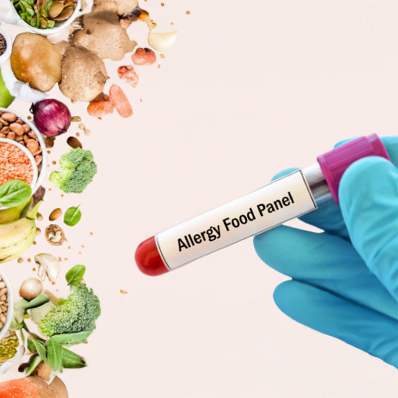 Allergy Food Panel