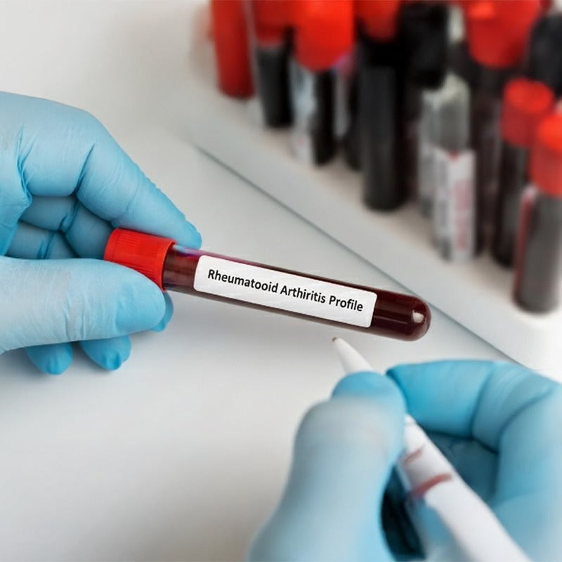 Rheumatoid Arthritis Profile