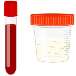 Semen/Sperm Test