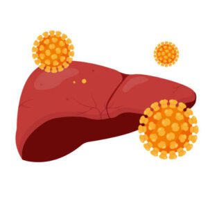 Hepatitis Profile