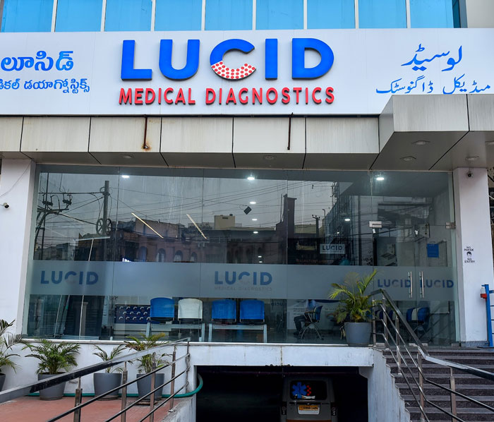 Lucid Medical Diagnostics | Himayatnagar